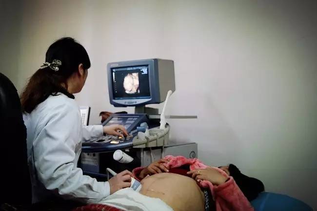 四维彩超能查出胎儿正常吗,四维彩超能看出胎儿异常吗