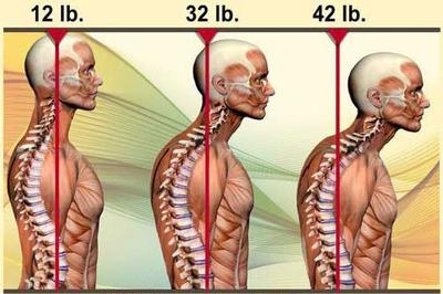 一抬头脊椎疼怎么缓解,抬头颈椎疼如何缓解