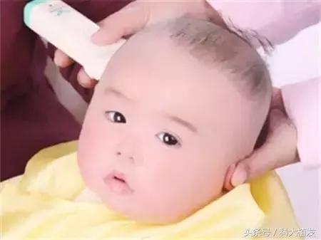 小孩不长头发,小孩不长头发怎么治疗