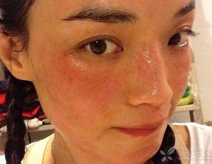 脸上长斑应该如何调理才能祛斑,脸上长斑最有效的祛斑方法