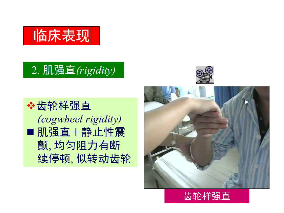 多图详解帕金森及运动障碍性疾病|关于帕金森最全的一个课件
