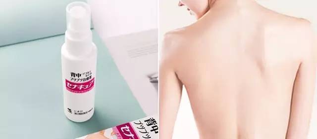 去除背部痘痘神器,修复痘痘肌的好物