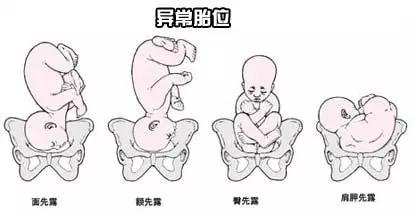 孕期胎位不正怎么调整,孕期胎位不正艾灸注意事项