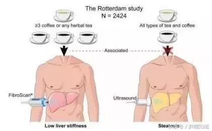 喝咖啡能防肝硬化？吓得我又多喝了一口！