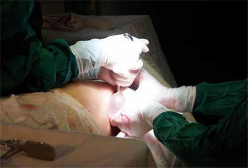 节育环会导致身体一直发炎吗,节育环会引发感染吗