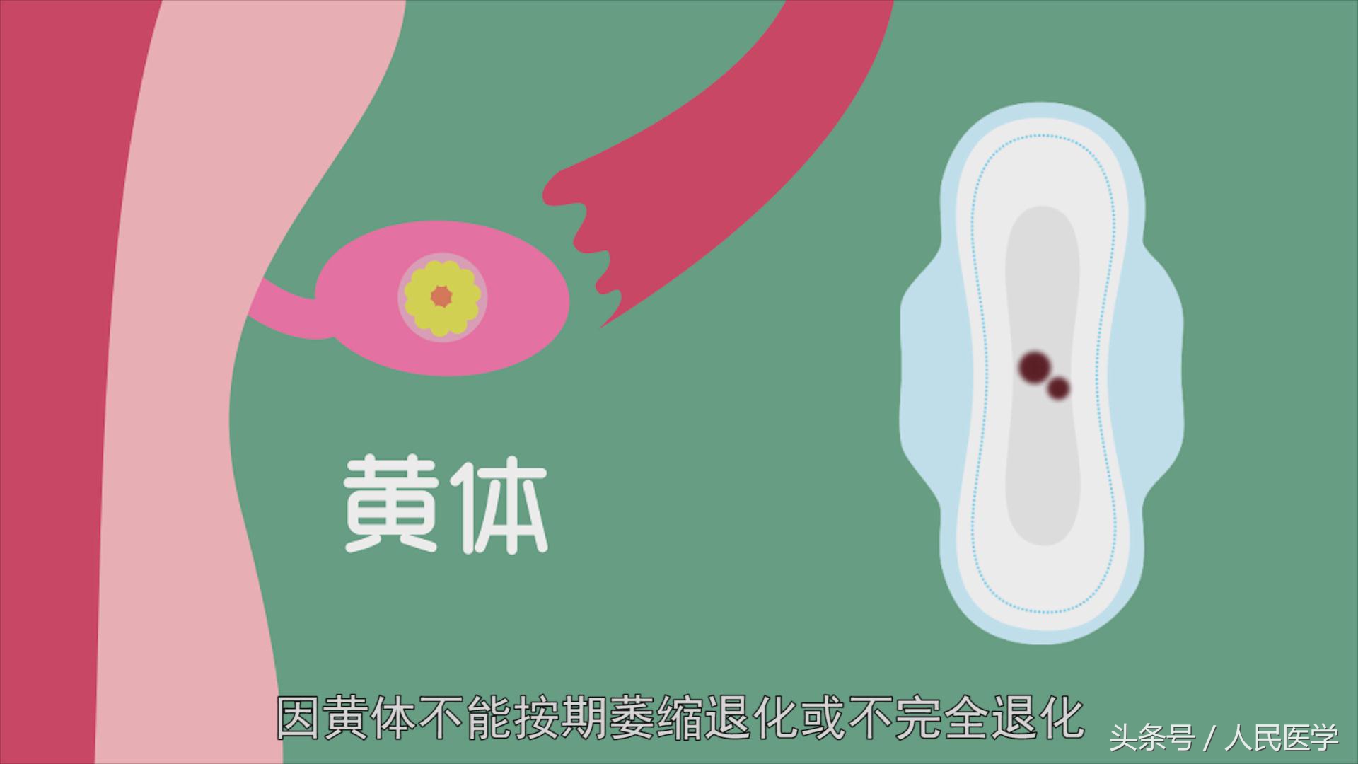 别把月经不调当儿戏警惕七大危害,千万别把月经量少不当一回事