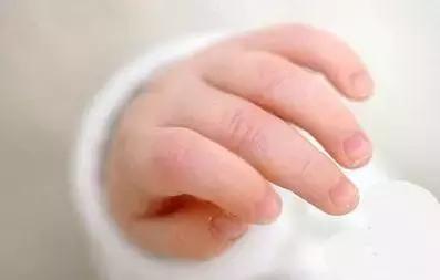 指甲整个掉了需要注意哪些,小孩的指甲应该怎么处理