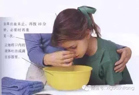 宝宝半夜流鼻血是白血病的前兆吗,宝宝经常流鼻血是白血病的前兆吗