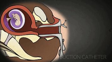 LAN《性、安全、录像带》