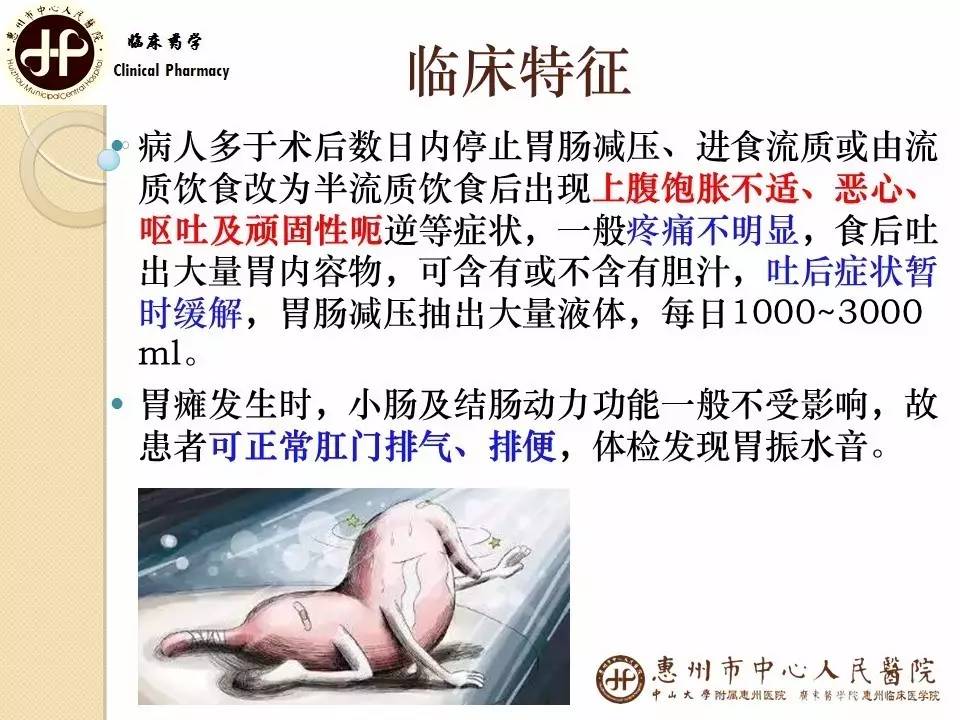 胃瘫是什么意思,胃瘫多久能恢复