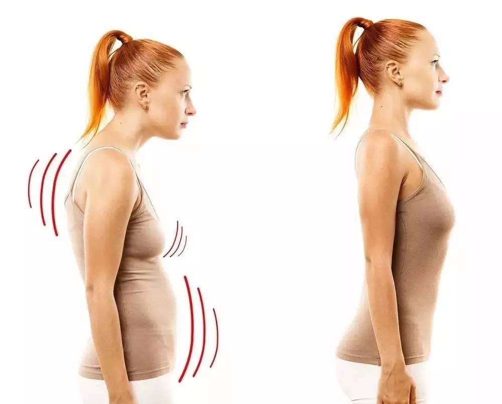 驼背矫正怎么练,驼背正确练法