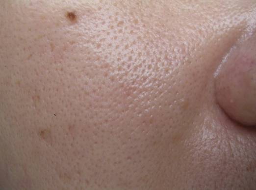 战痘大结局完整版,战痘合集完整版