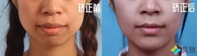 医生郭涛,正畸郭涛