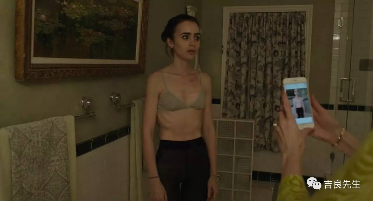 过度减肥的皮囊有多可怕？这位小公主就体验过