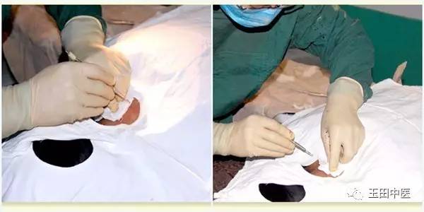 疼痛科最佳诊断,疼痛科专用器械大全