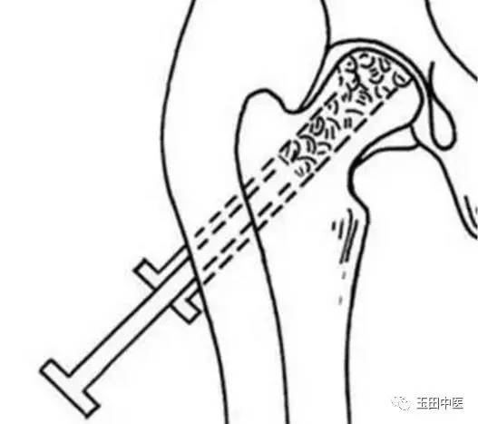疼痛科最佳诊断,疼痛科专用器械大全