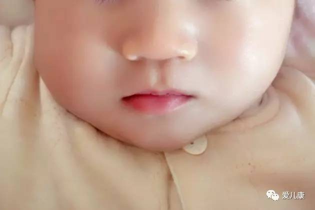 新生儿脸睡偏了如何纠正,宝宝的脸一边大一边小怎么矫正