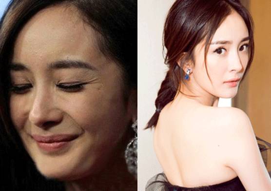 明星改善皮肤暗沉毛孔粗大,修复毛孔粗大明星推荐