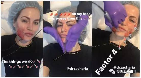 欧美皮肤管理,ins很火皮肤管理