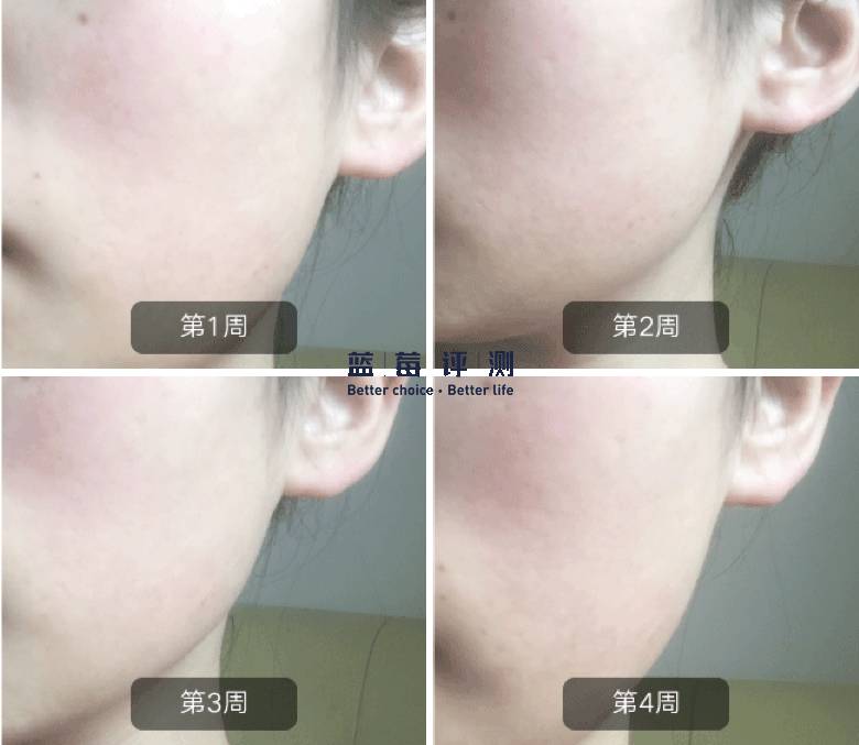 有哪些比较好用的美容仪可以推荐,最好用的有效的美容仪