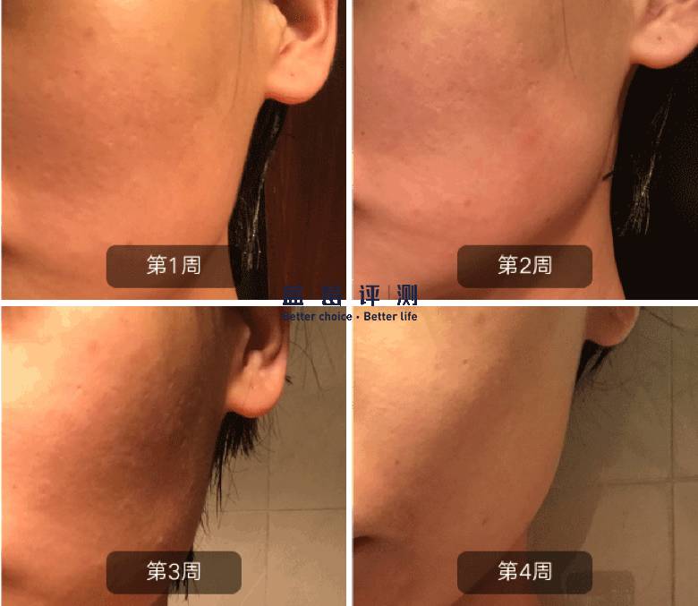 有哪些比较好用的美容仪可以推荐,最好用的有效的美容仪