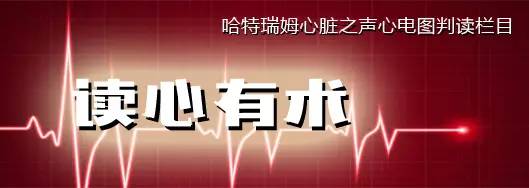 「读心有术」168期：房扑也能文氏传导，你听说过吗？