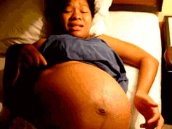 科普一刻｜你真的了解顺产、剖腹产和无痛分娩吗？