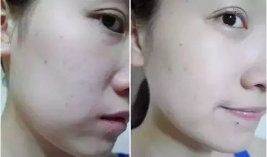 压力山大的时候要如何调整皮肤状态？