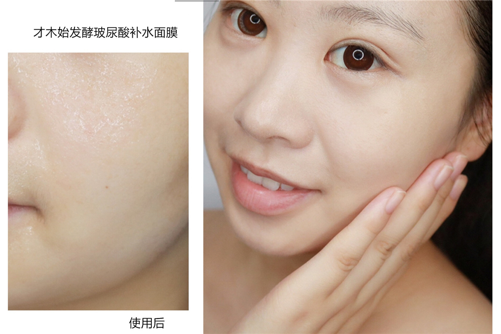干皮公认最好用的玻尿酸面膜,混干皮敏感肌用的补水美白面膜