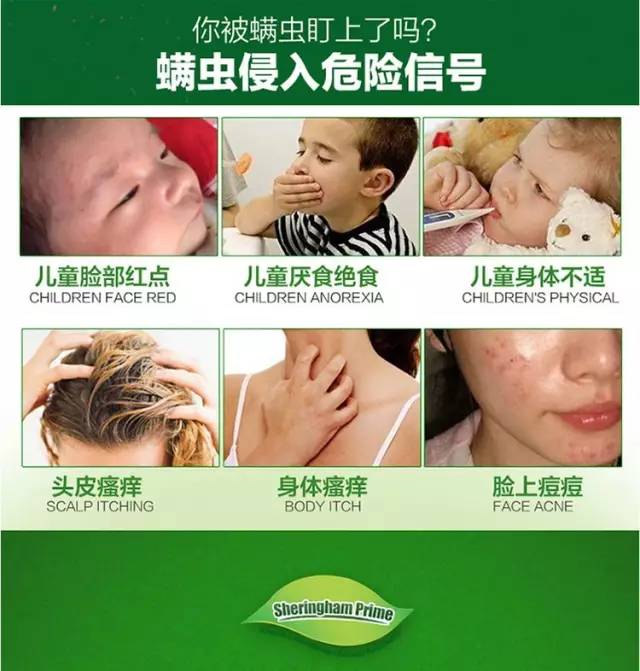 儿童除螨睡眠枕头,儿童螨虫喷雾床上怎么使用