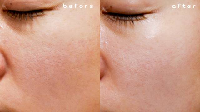 风很大又好用的化妆品,兰蔻小安瓶效果