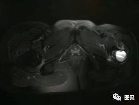 髋部疼痛做什么检查,左髋部疼痛待查病例