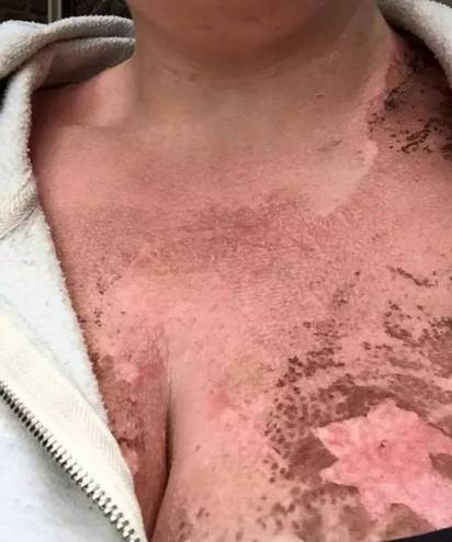 防晒霜哪个牌子的好用不伤脸,什么牌子防晒霜好用不伤脸