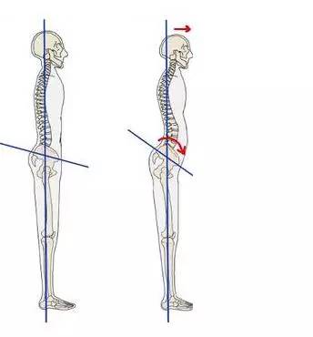 腰痛神奇针灸,腰痛的神奇秘方