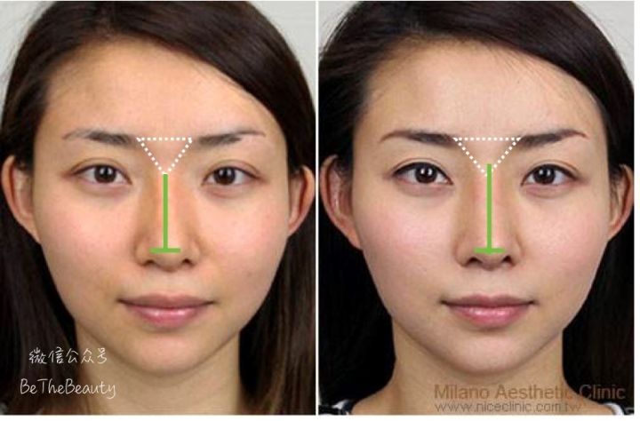 鼻翼宽鼻头大怎么办,塌鼻子鼻翼宽妆容