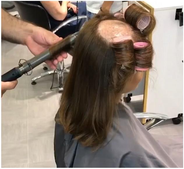 黑科技脱发,国外脱发神器