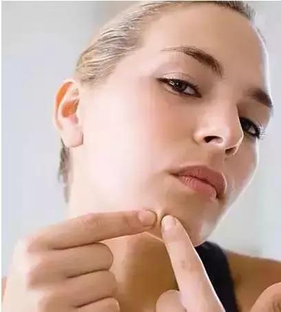 一个地方反反复复长痘是什么原因,不同位置超详细的长痘原因剖析