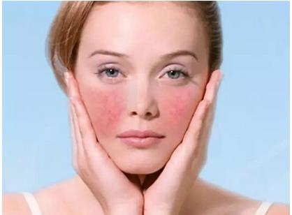 彻底祛除红血丝的小妙招,眼白血丝消除最快方法