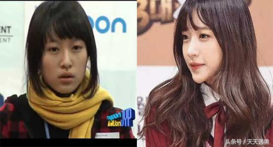 王思聪签的韩国女团EXID不承认整容，还做CT，被网友啪啪打脸！