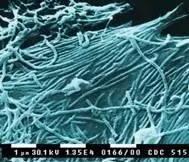 狂犬病毒vs埃博拉病毒,埃博拉病毒和狂犬病毒哪个更厉害