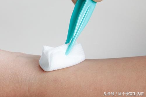 生活中烫伤抹什么,生活小妙招烫伤