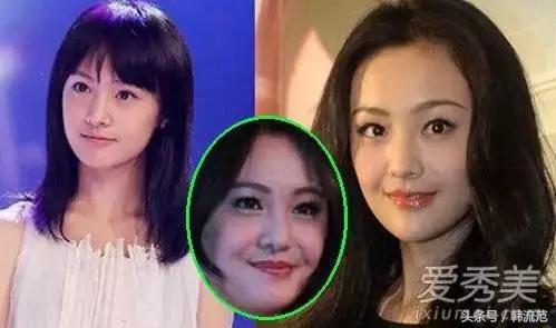 给你一万块买裤子还是买衣服,护肤和微整