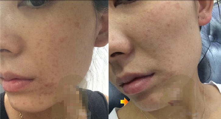 理发师号称养生治疾病,骗女子*款贷**20万办疗程,到底是什么病