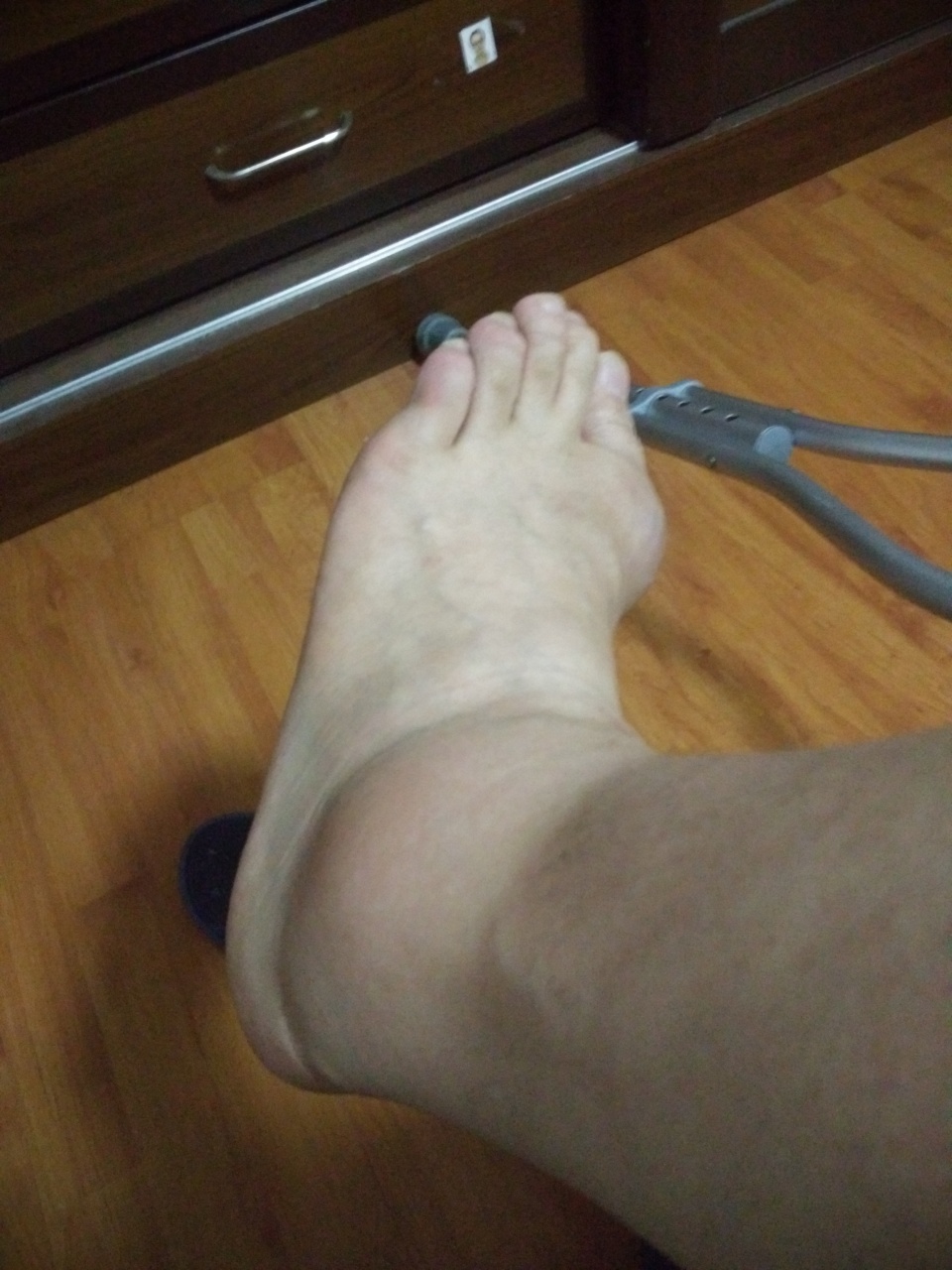 痛风还得是刚做完手术的飞哥跟你聊