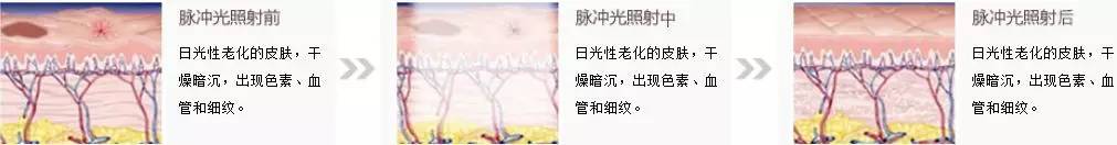 资生堂紧急召回41万件安耐晒？小心你的脸！