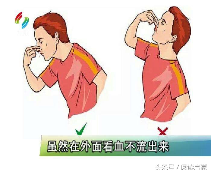 小孩摔倒后流鼻血是什么原因,宝宝摔倒过了几个小时后流鼻血