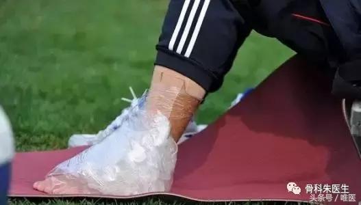 骨科医生脚崴了用什么药,一个真正的医生谈脚踝扭伤处理