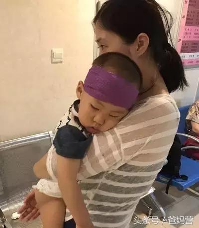 孩子摔跤到膝盖出血该怎么处理,四岁孩子摔跤缝了22针