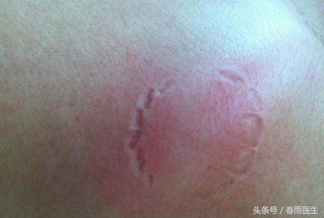 被人咬了能让对方赔偿吗,被人咬了要赔钱吗