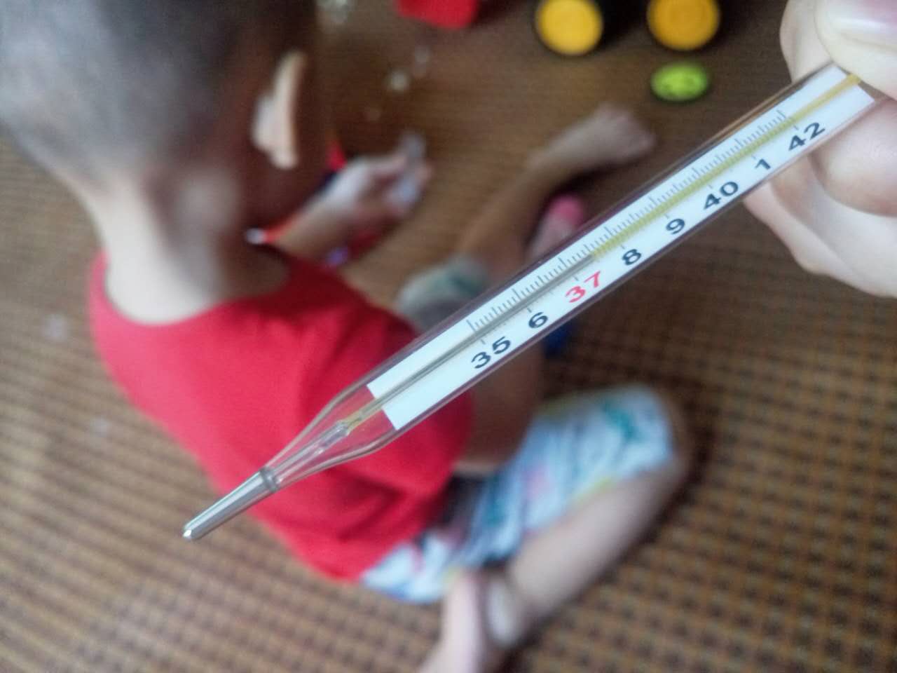 2岁宝宝老是得咽峡炎疱疹,得了疱疹性咽峡炎还会有手足口吗